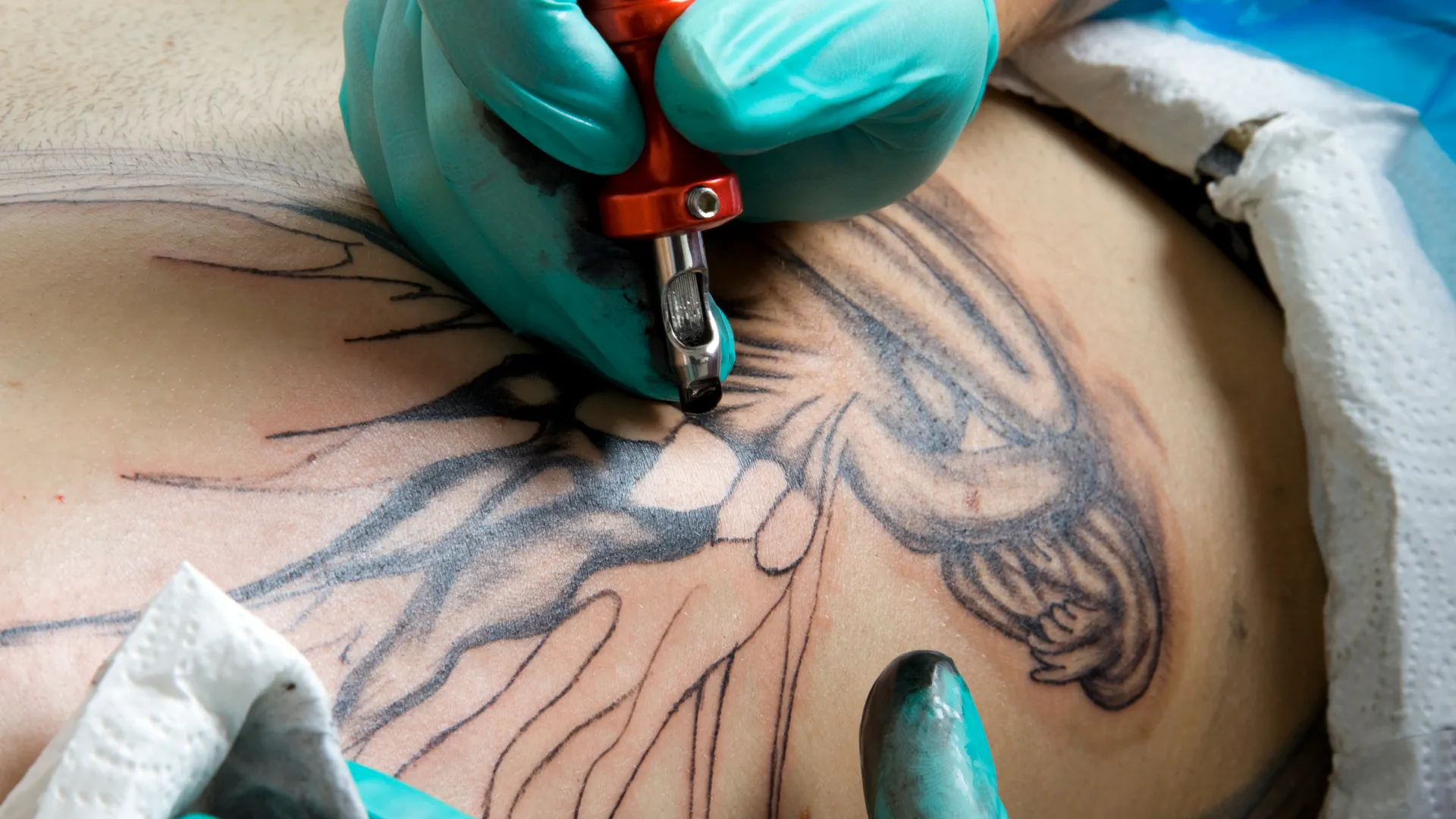 How to remove tattoo with its pros and cons